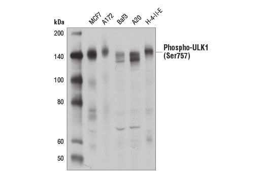Western Blotting Image 2: Phospho-ULK1 (Ser757) (D7O6U) Rabbit Monoclonal Antibody