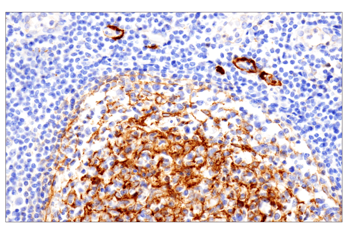 Immunohistochemistry Image 9: Vitronectin (F8D3L) Rabbit Monoclonal Antibody