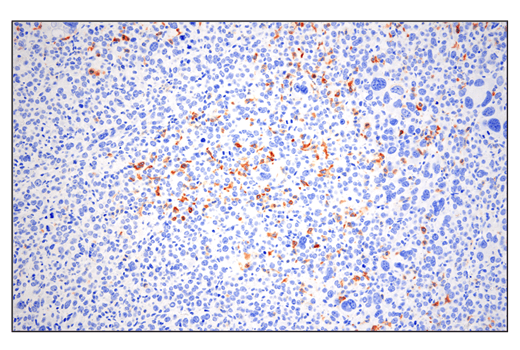 Immunohistochemistry Image 4: Phospho-SLP-76 (Ser376) (E3G9U) Rabbit Monoclonal Antibody (BSA and Azide Free)