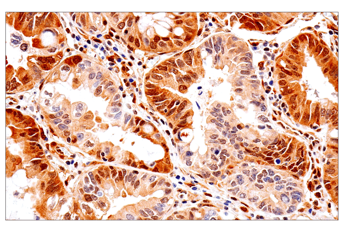 Immunohistochemistry Image 1: PTEN (D4.3) Rabbit Monoclonal Antibody