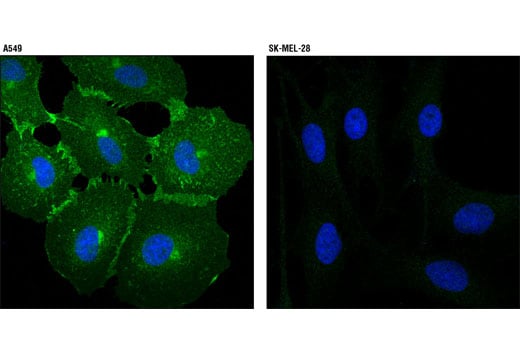 Immunofluorescence Image 1: EphA2 (D4A2) XP<sup>®</sup> Rabbit mAb (BSA and Azide Free)
