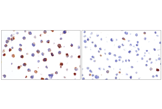 Immunohistochemistry Image 9: GNLY (E2T3D) Rabbit Monoclonal Antibody