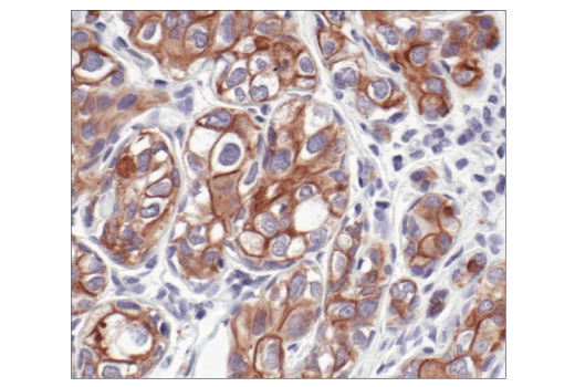 Immunohistochemistry Image 5: Pan-Keratin (C11) Mouse Monoclonal Antibody (BSA and Azide Free)