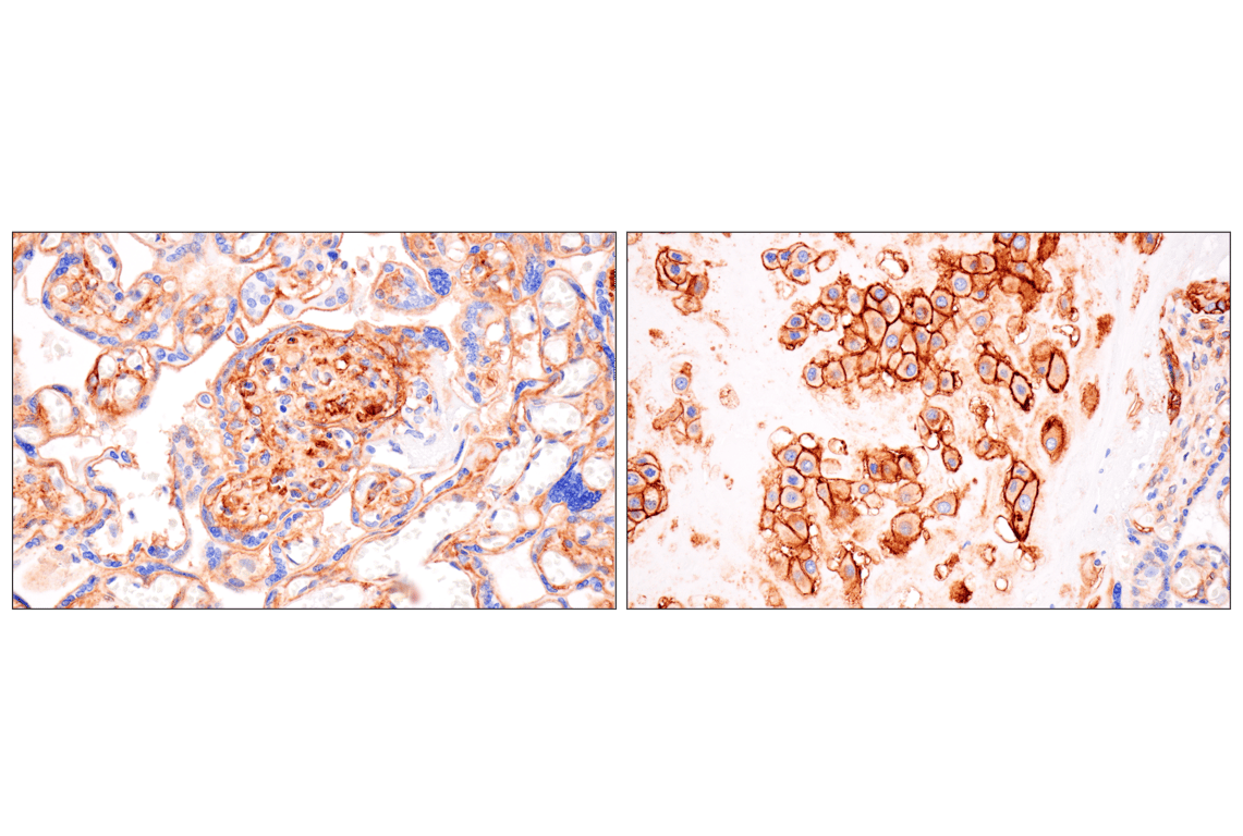 Immunohistochemistry Image 5: B7-H3 (D9M2L) Rabbit Monoclonal Antibody