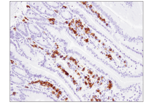 Immunohistochemistry Image 4: CD79B (D7V2F) Rabbit Monoclonal Antibody