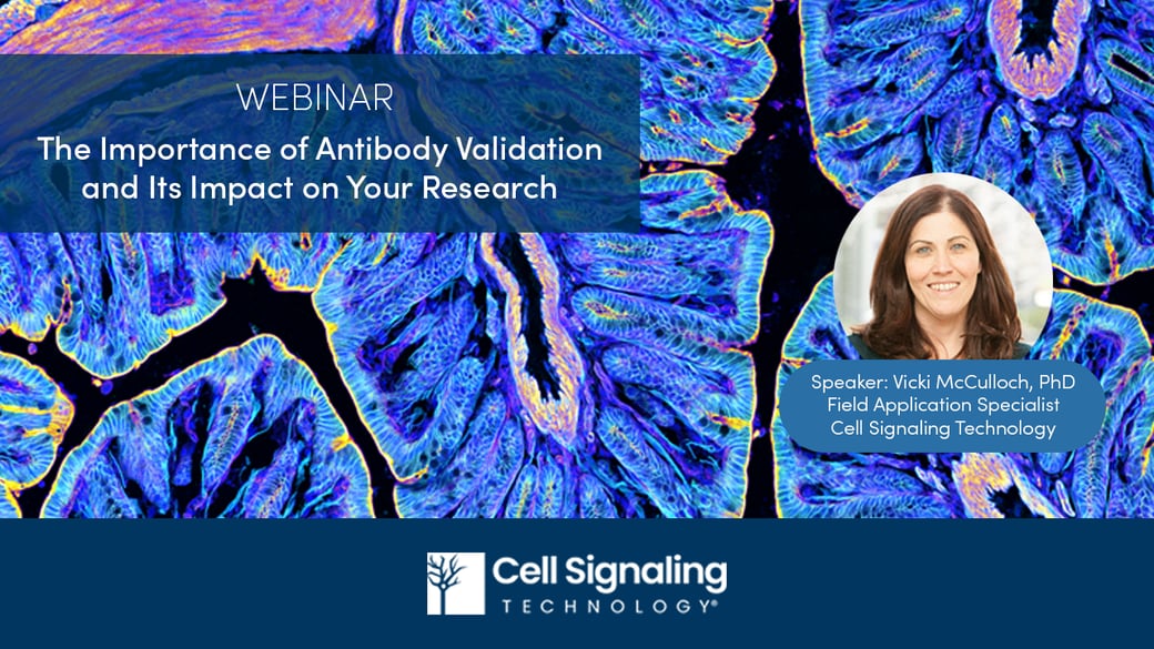 Watch this webinar on the critical role of antibody validation in experimental success. Learn strategies to ensure immunoassay reproducibility and optimize your protocols.