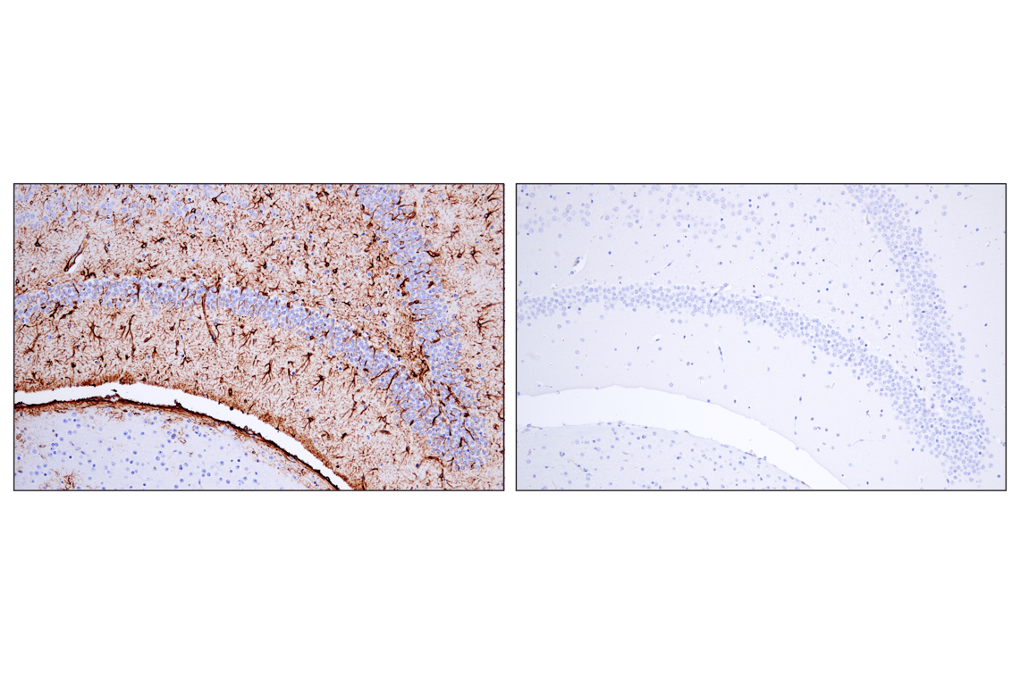 Immunohistochemistry Image 4: GFAP (E4L7M) XP<sup>®</sup> Rabbit mAb (BSA and Azide Free)