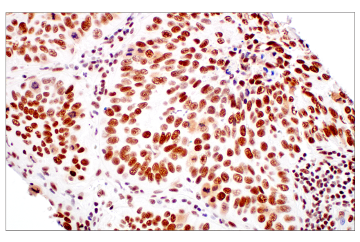 Immunohistochemistry Image 2: METTL3 (E3F2A) Rabbit Monoclonal Antibody (BSA and Azide Free)