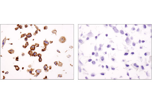 Immunohistochemistry Image 3: EphA2 (D4A2) Rabbit Monoclonal Antibody