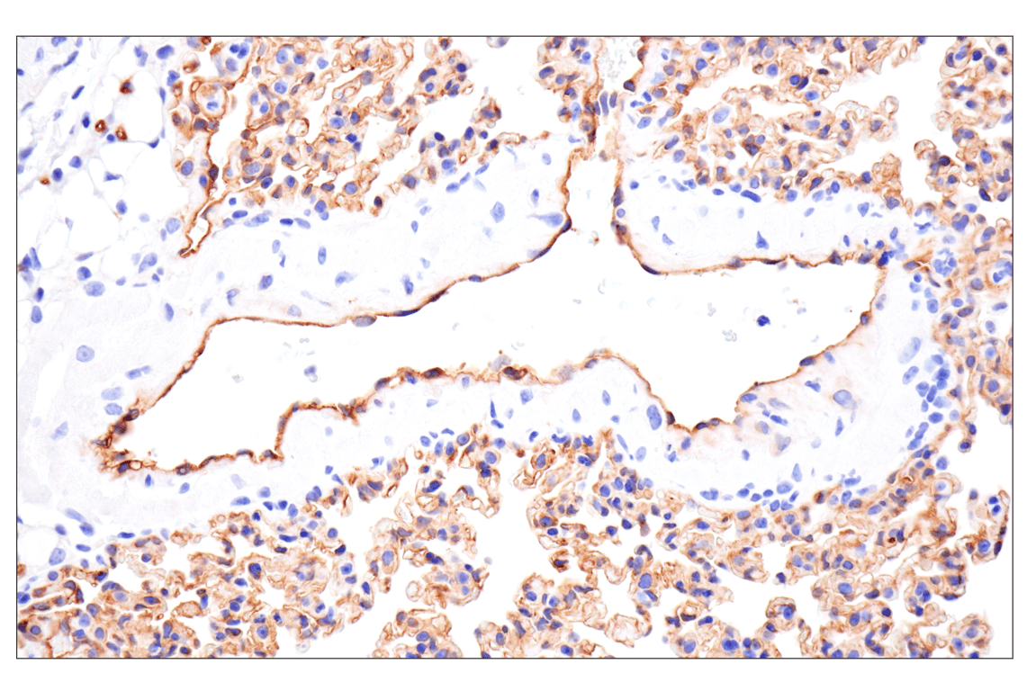 Immunohistochemistry Image 4: ESAM (F9D9P) Rabbit Monoclonal Antibody