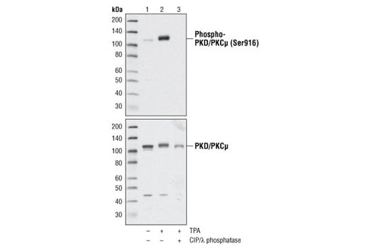 undefined Image 2: TPA (12-O-Tetradecanoylphorbol-13-Acetate)