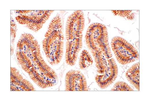 Immunohistochemistry Image 10: CMTM6 (E6A8T) Rabbit Monoclonal Antibody