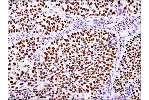 Immunohistochemistry Image 2: Acetyl-Histone H3 (Lys18) (D8Z5H) Rabbit Monoclonal Antibody