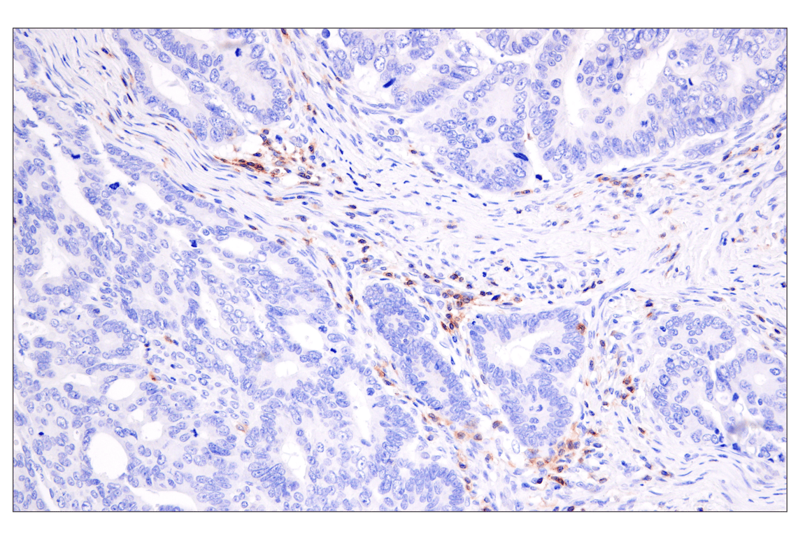 Immunohistochemistry Image 1: CD28 (D2Z4E) Rabbit Monoclonal Antibody