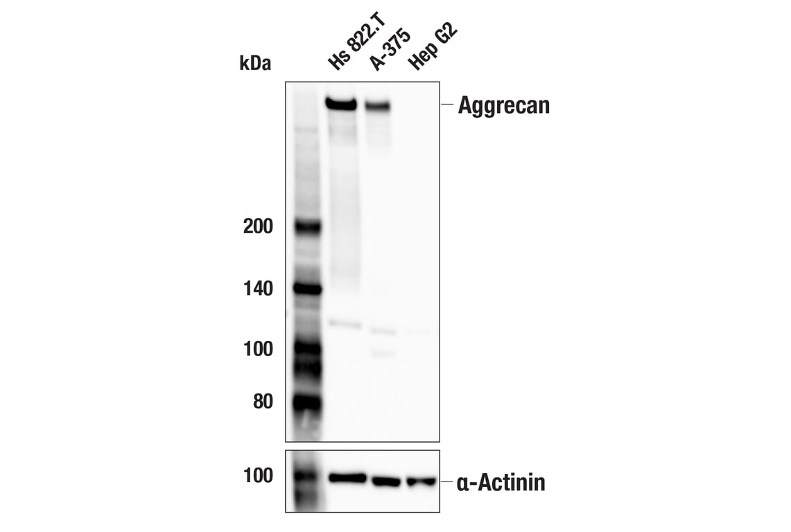 Western Blotting Image 2: Aggrecan (E8B8S) Rabbit Monoclonal Antibody