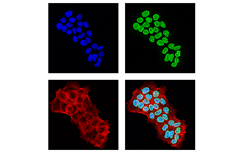 Immunofluorescence Image 1: NUP153 (E3I6Z) Rabbit Monoclonal Antibody