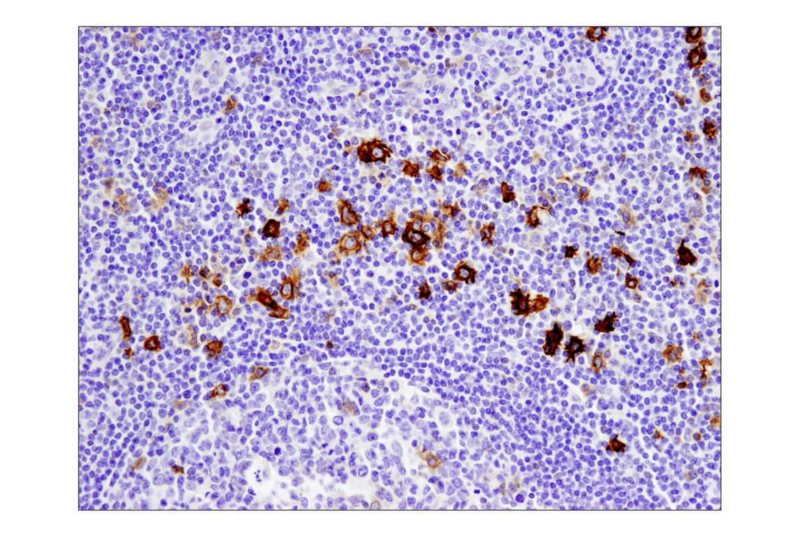 Immunohistochemistry Image 4: TNFRSF8/CD30 (E4L4I) Rabbit Monoclonal Antibody (BSA and Azide Free)