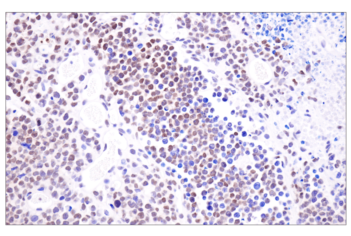Immunohistochemistry Image 9: Acetyl-Histone H4 (Lys16) (E2B8W) Rabbit Monoclonal Antibody (BSA and Azide Free)