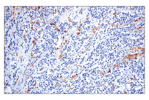 Immunohistochemistry Image 2: CD86 (E2G8P) Rabbit Monoclonal Antibody