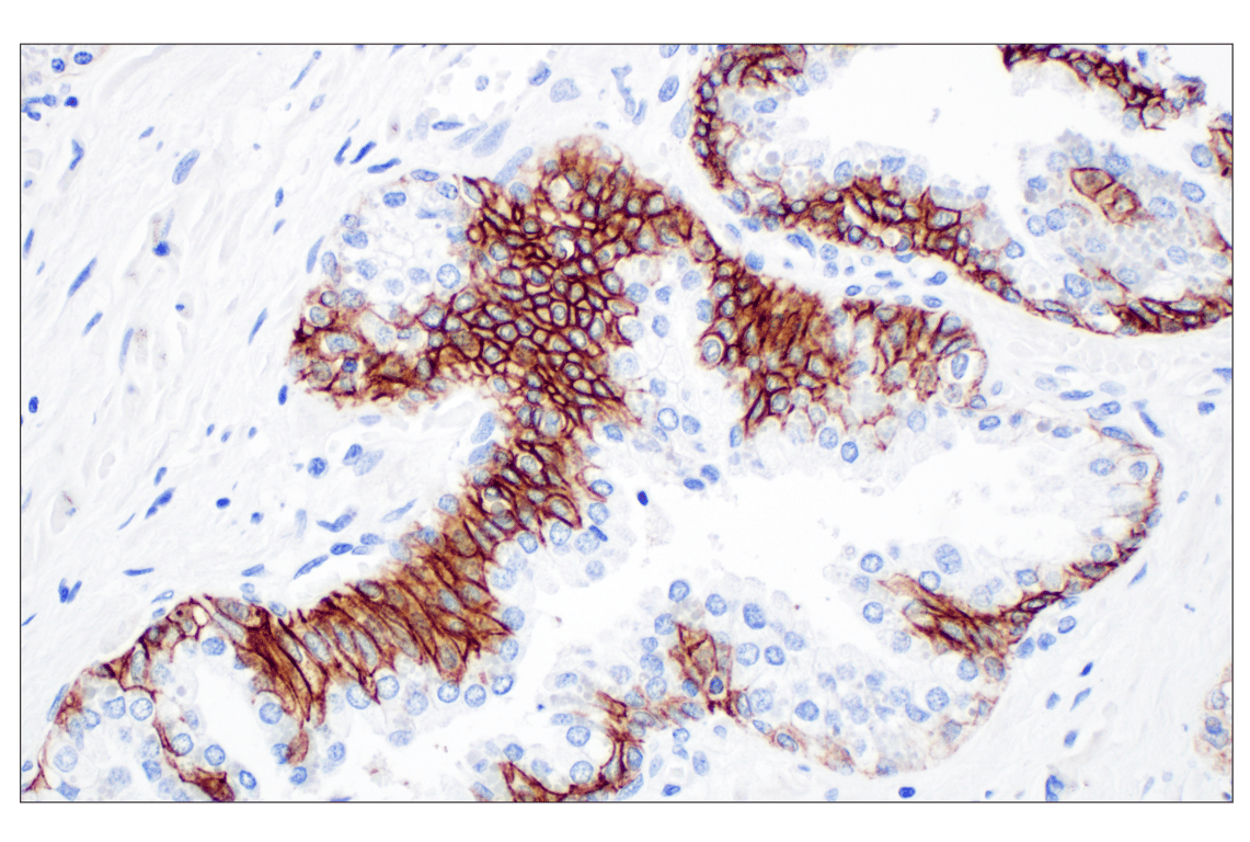 Immunohistochemistry Image 2: CD44 v6 (C44Mab-9) Mouse Monoclonal Antibody