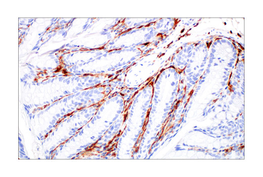CD206/MRC1 (E6T5J) XP® Rabbit mAb (#24595) Datasheet With