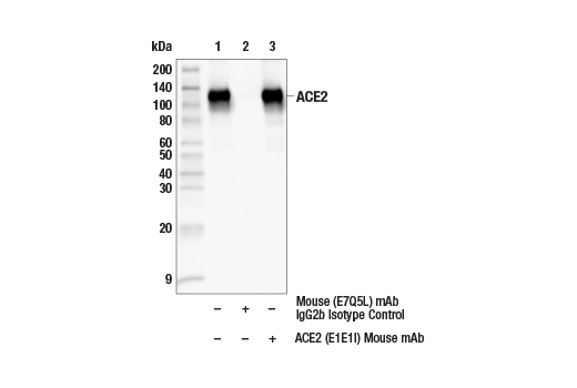 Immunoprecipitation Image 1: ACE2 (E1E1I) Mouse Monoclonal Antibody