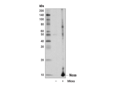 undefined Image 22: Pro-Apoptosis Bcl-2 Family Antibody Sampler Kit II