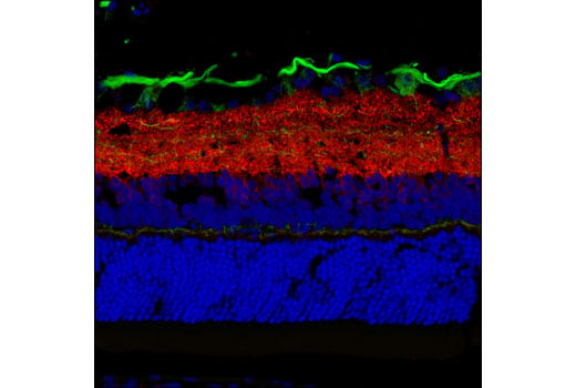 Immunofluorescence Image 1: Synapsin-1 (D12G5) XP<sup>®</sup> Rabbit mAb (Alexa Fluor<sup>®</sup> 594 Conjugate)