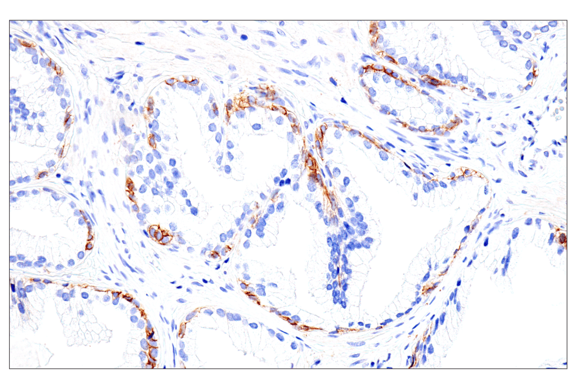 Immunohistochemistry Image 11: Syndecan 1 (E7F7T) Rabbit Monoclonal Antibody (BSA and Azide Free)