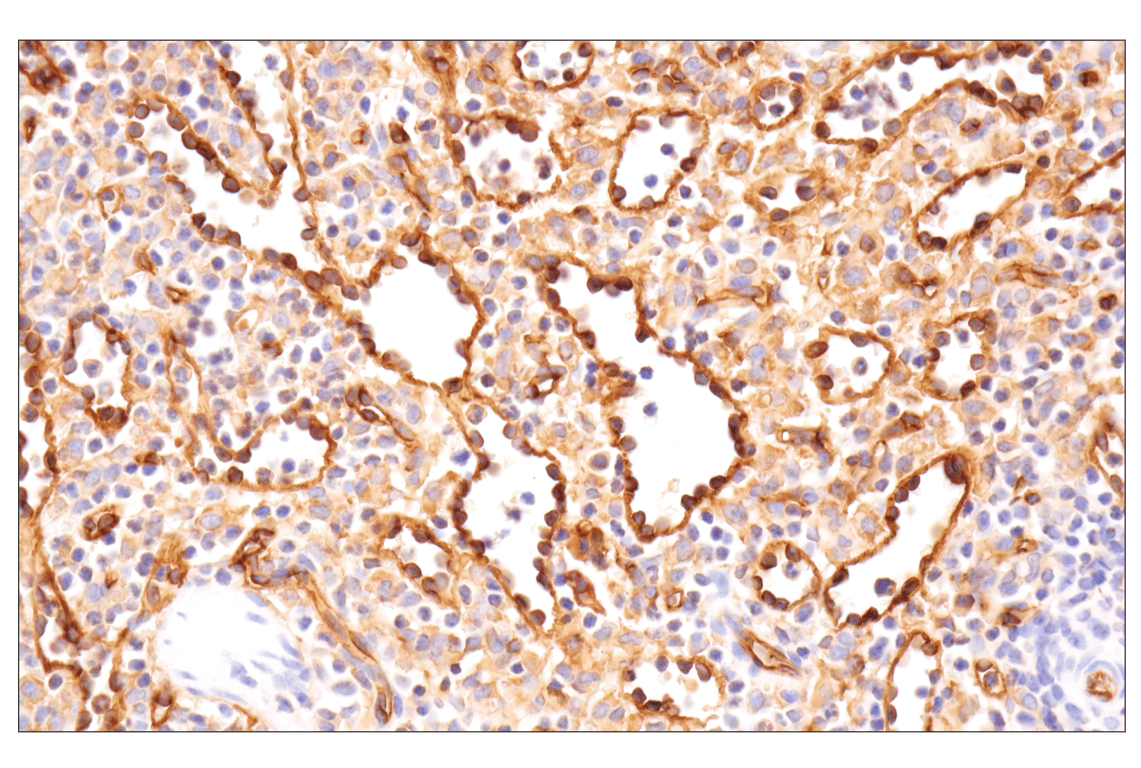 Immunohistochemistry Image 4: CD36 (D8L9T) Rabbit Monoclonal Antibody (BSA and Azide Free)