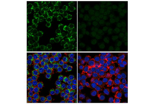 Immunofluorescence Image 1: CD68 (E3O7V) Rabbit Monoclonal Antibody (Alexa Fluor<sup>®</sup> 488 Conjugate)