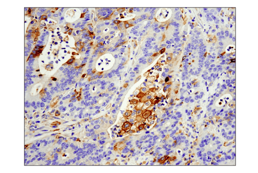 Immunohistochemistry Image 1: IFIT1 (D2X9Z) Rabbit Monoclonal Antibody (BSA and Azide Free)