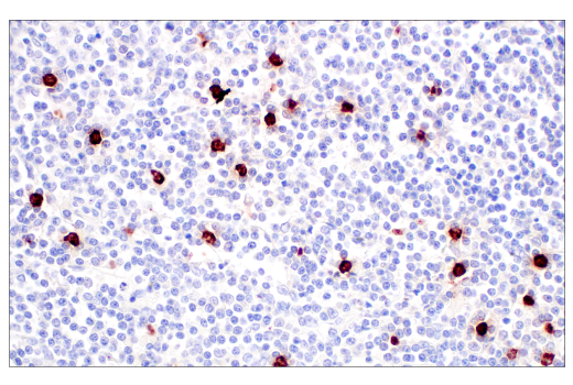 Immunohistochemistry Image 5: MMP-8 (E1C4L) Rabbit Monoclonal Antibody