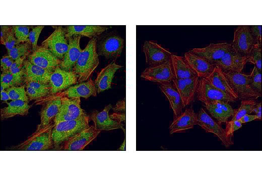 Immunofluorescence Image 1: Phospho-HSP27 (Ser82) Antibody