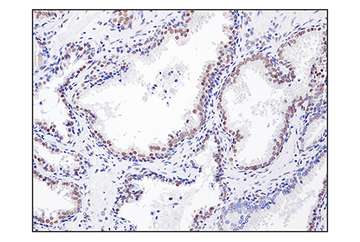 Immunohistochemistry Image 4: SS18 (D6I4Z) Rabbit Monoclonal Antibody (BSA and Azide Free)