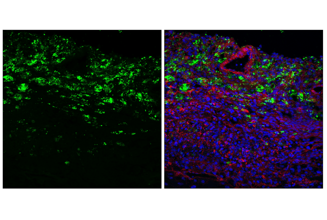 Immunofluorescence Image 1: Granzyme C (E5M3N) Rabbit mAb