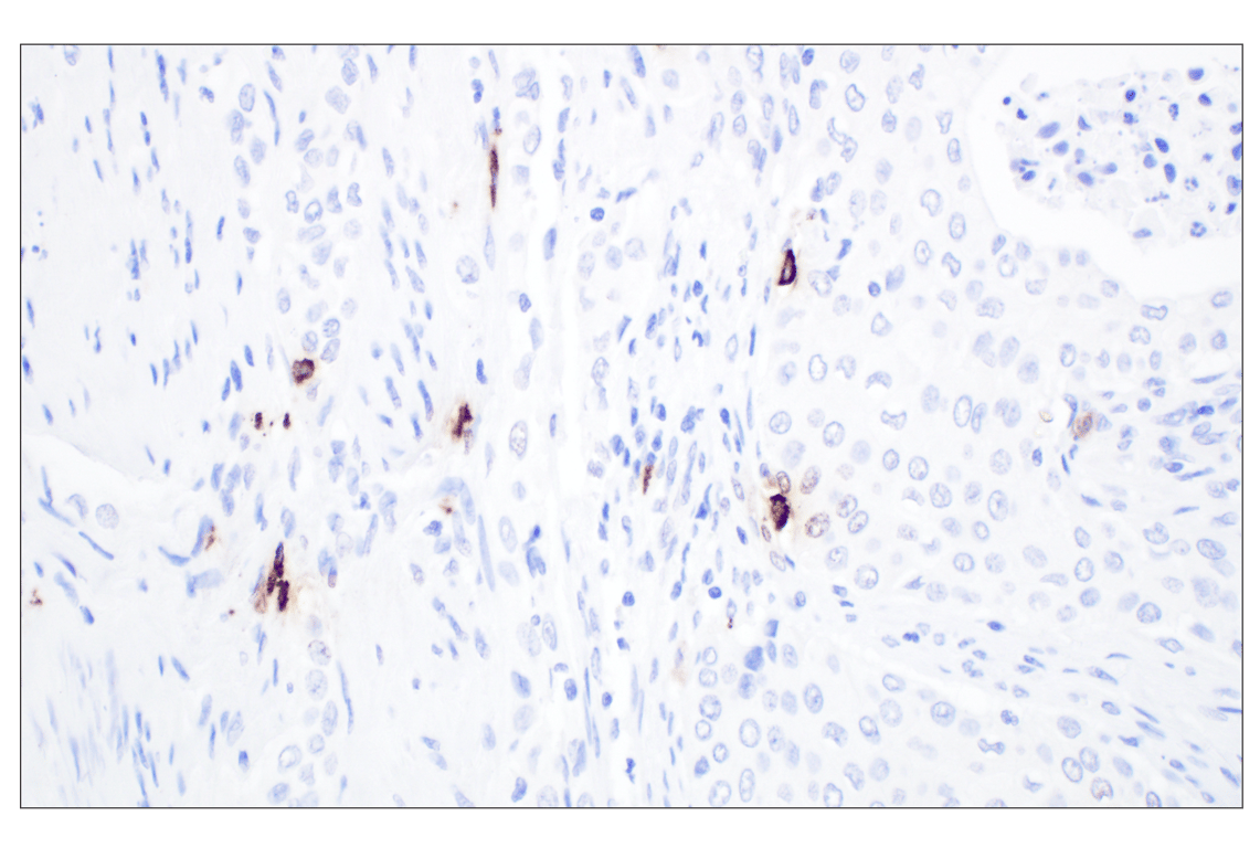 Immunohistochemistry Image 3: Mast Cell Chymase/CMA1 (F6S4Q) Rabbit Monoclonal Antibody