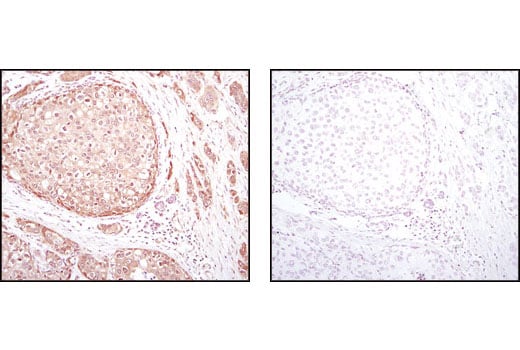 Immunohistochemistry Image 2: Akt (pan) (C67E7) Rabbit Monoclonal Antibody (BSA and Azide Free)