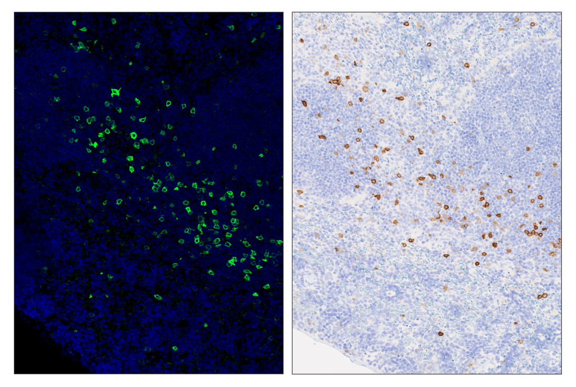 Immunohistochemistry Image 6: IL-2R alpha/CD25 (E9W2J) & CO-0074-594 SignalStar<sup>™</sup> Oligo-Antibody Pair