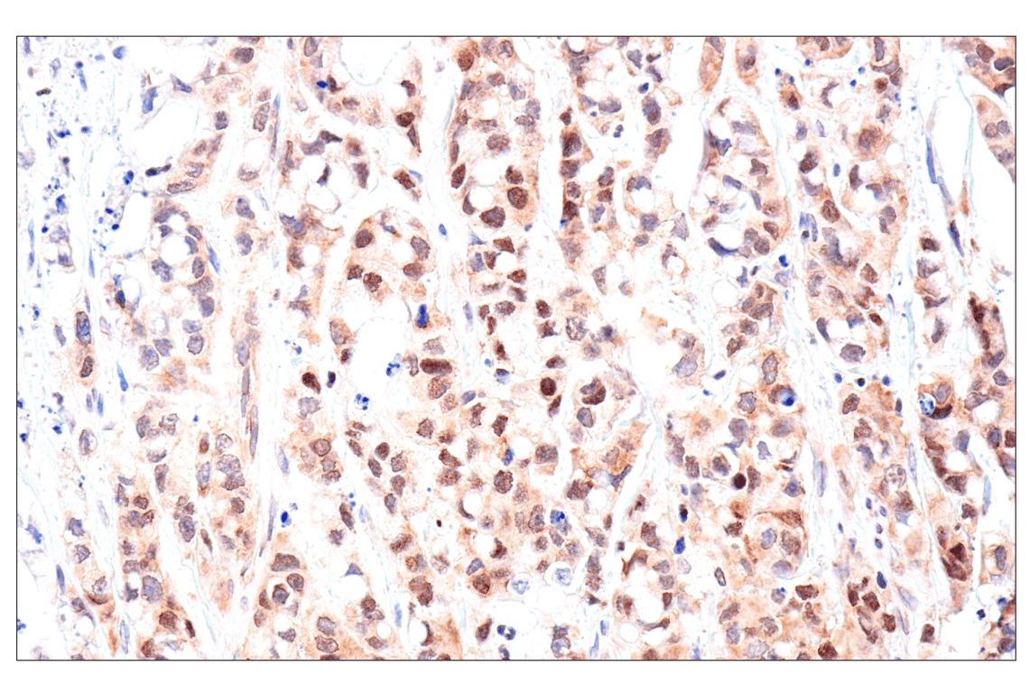 Immunohistochemistry Image 7: ADAR1 p150 Isoform (E6U1U) Rabbit Monoclonal Antibody