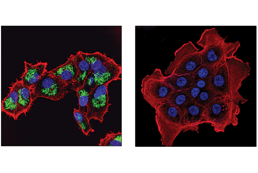 Immunofluorescence Image 1: Malic Enzyme 2 (E1N3E) Rabbit Monoclonal Antibody