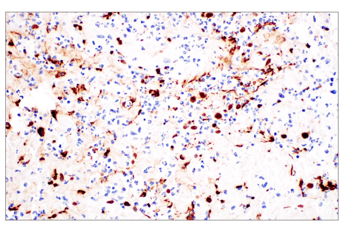 Immunohistochemistry Image 3: Citrullinated Histone H3 (Arg2) (F3C9B) Rabbit mAb (IHC Formulated)