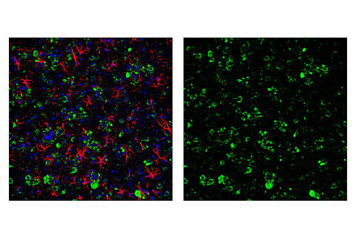 Immunofluorescence Image 2: APP (E9M5J) Rabbit Monoclonal Antibody