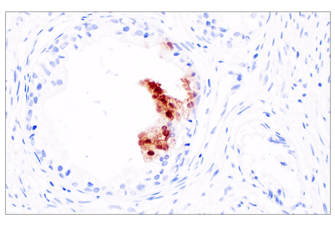 Immunohistochemistry Image 1: CXCL10 (F9N8I) Rabbit mAb