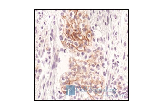 Immunohistochemistry Image 2: Phospho-HER3/ErbB3 (Tyr1289) (21D3) Rabbit Monoclonal Antibody