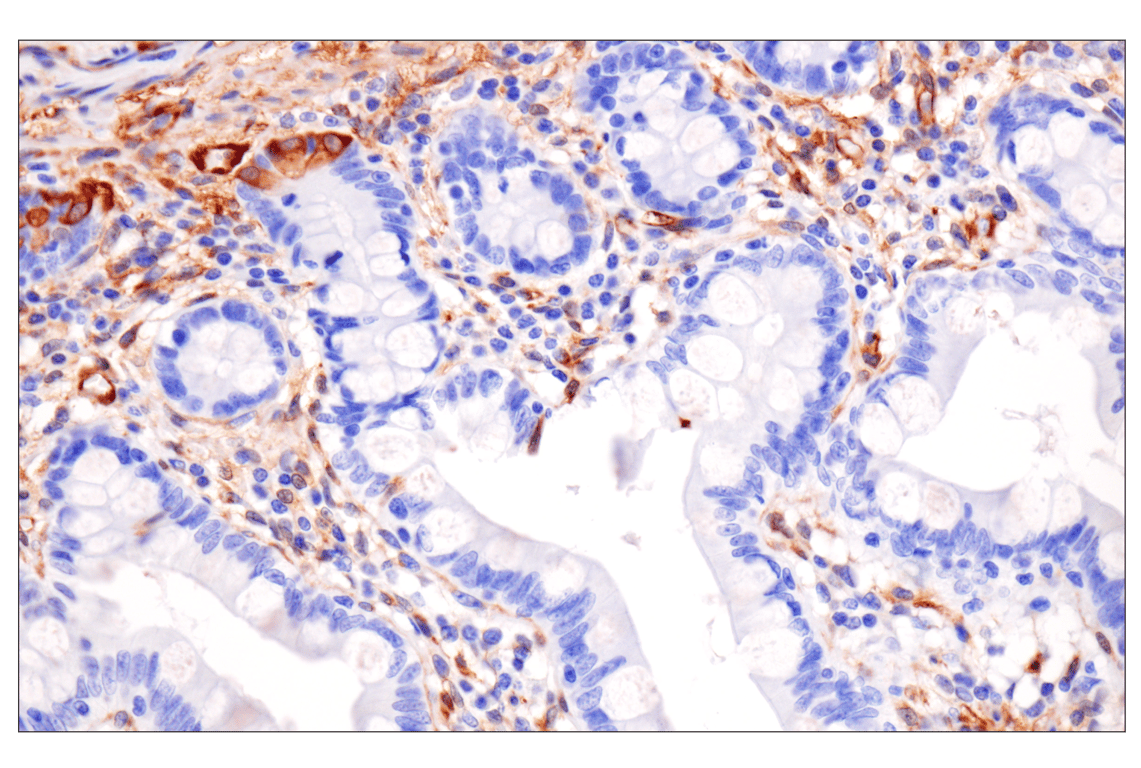 Immunohistochemistry Image 7: HSP27 (E1J4D) Rabbit Monoclonal Antibody