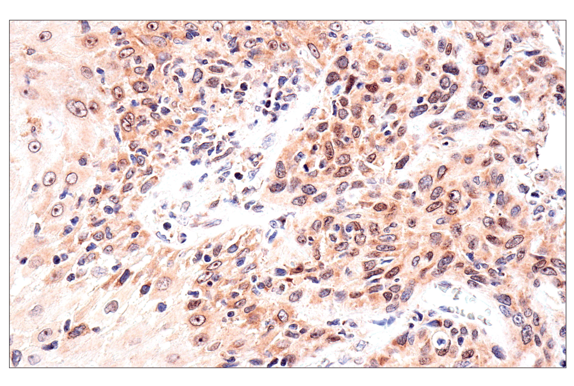 Immunohistochemistry Image 8: ADAR1 p150 Isoform (E6U1U) Rabbit Monoclonal Antibody