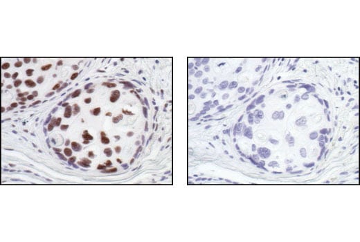 undefined Image 14: HSP/Chaperone Antibody Sampler Kit