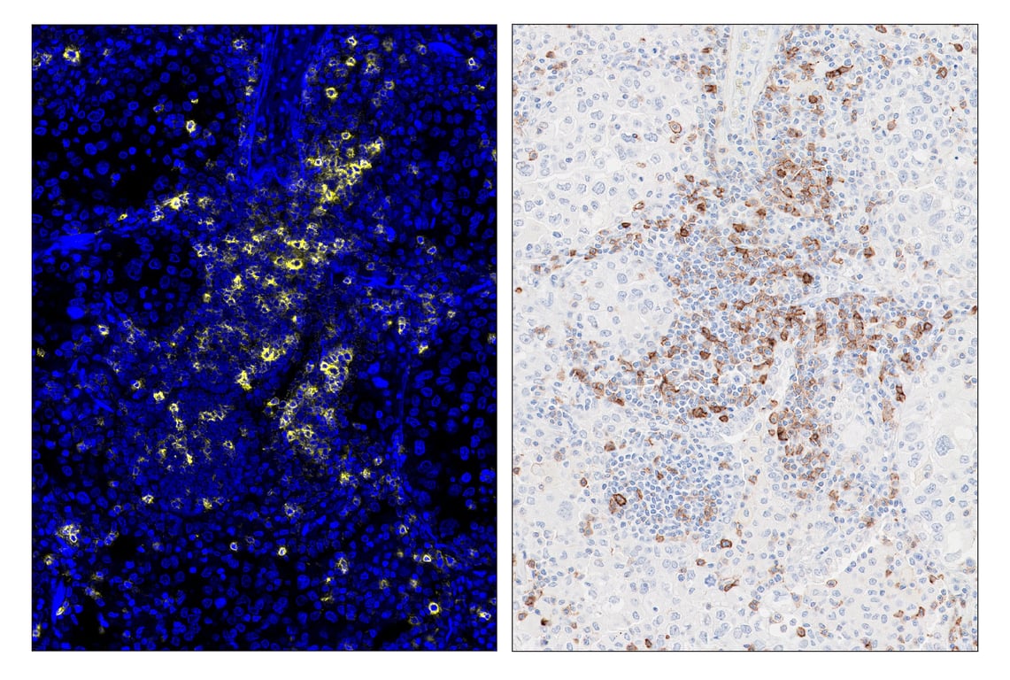 Immunohistochemistry Image 6: ICOS (D1K2T<sup>™</sup>) & CO-0027-488 SignalStar<sup>™</sup> Oligo-Antibody Pair