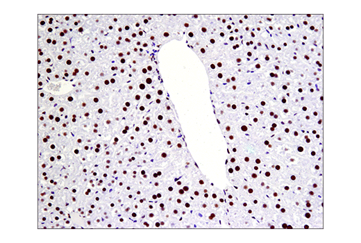 Immunohistochemistry Image 5: Phospho-ATF-2 (Thr71)/ATF-7 (Thr53) (E4A5G) Rabbit Monoclonal Antibody